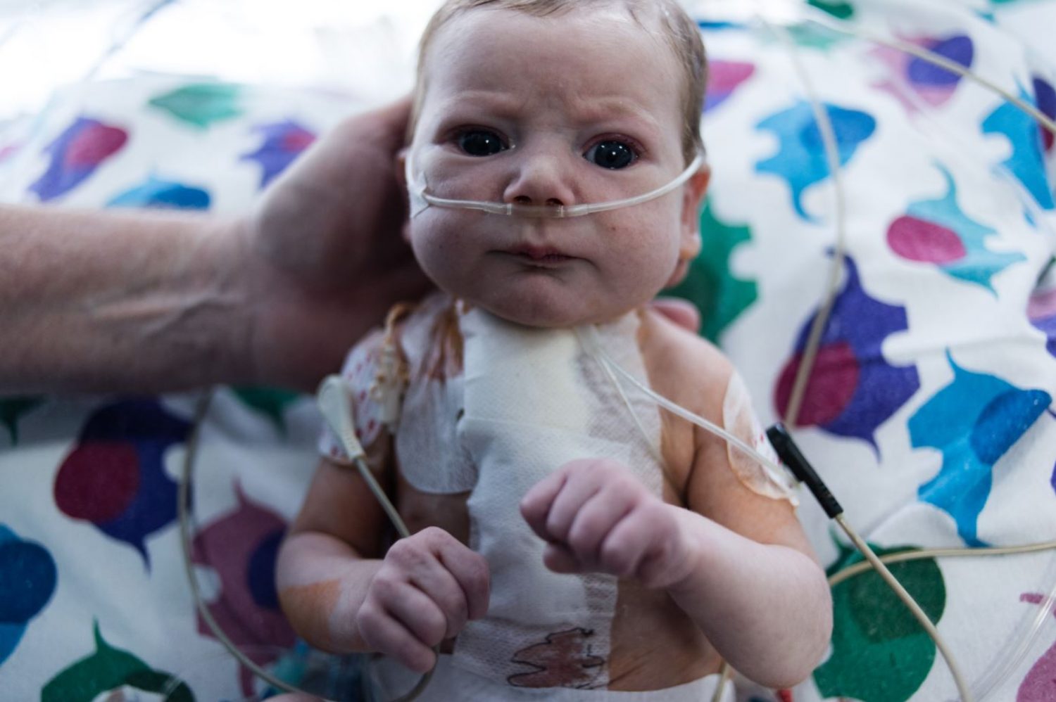 2-month-old-baby-Artur-who-is-currently-being-treated-in-Ukraine-8qb59suw55gp8v0zl0b24w6.jpg